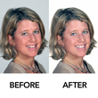 Retouching image 1 tn